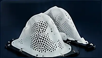 Thermoplastic contour masks for radiotherapy